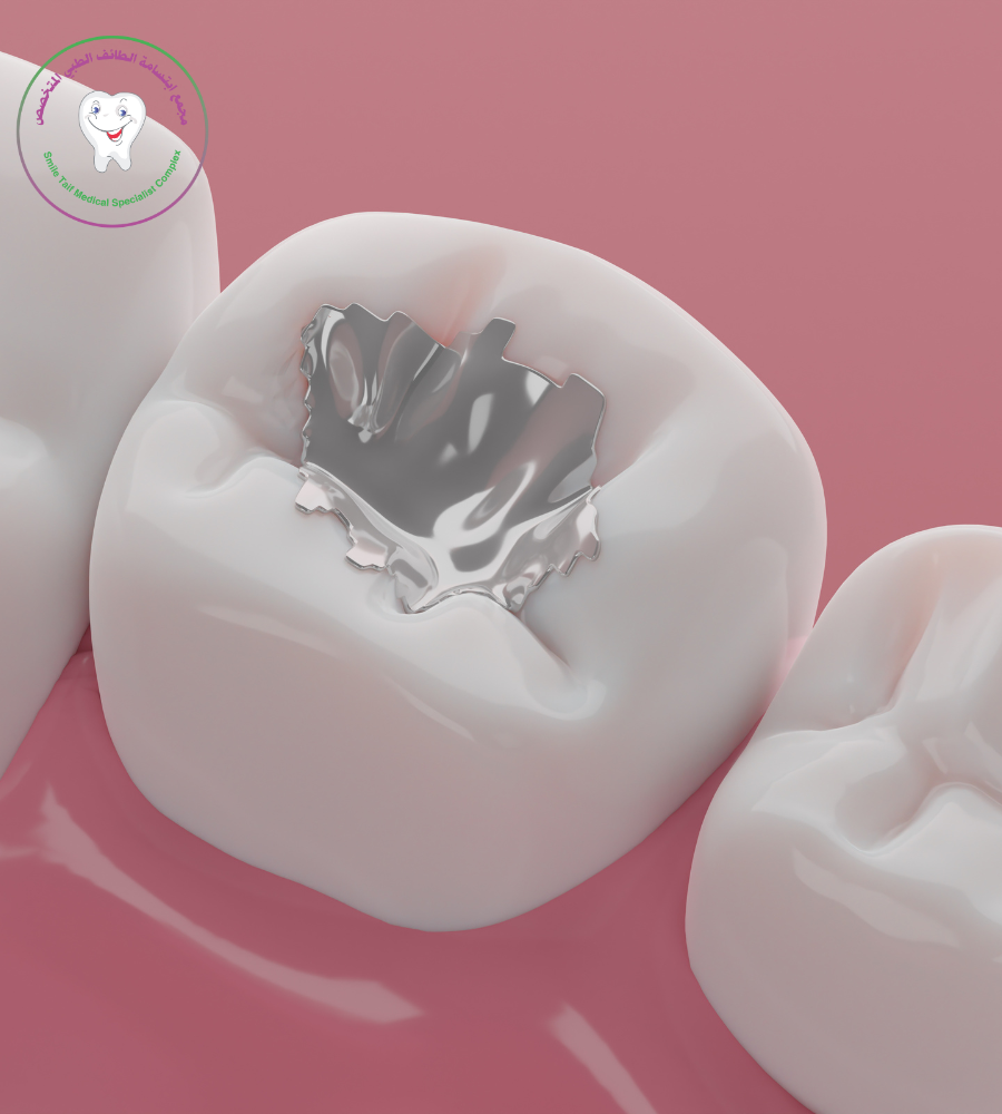 الحشوات التجملية الاسنان مجمع ابتسامة الطائف الطبي