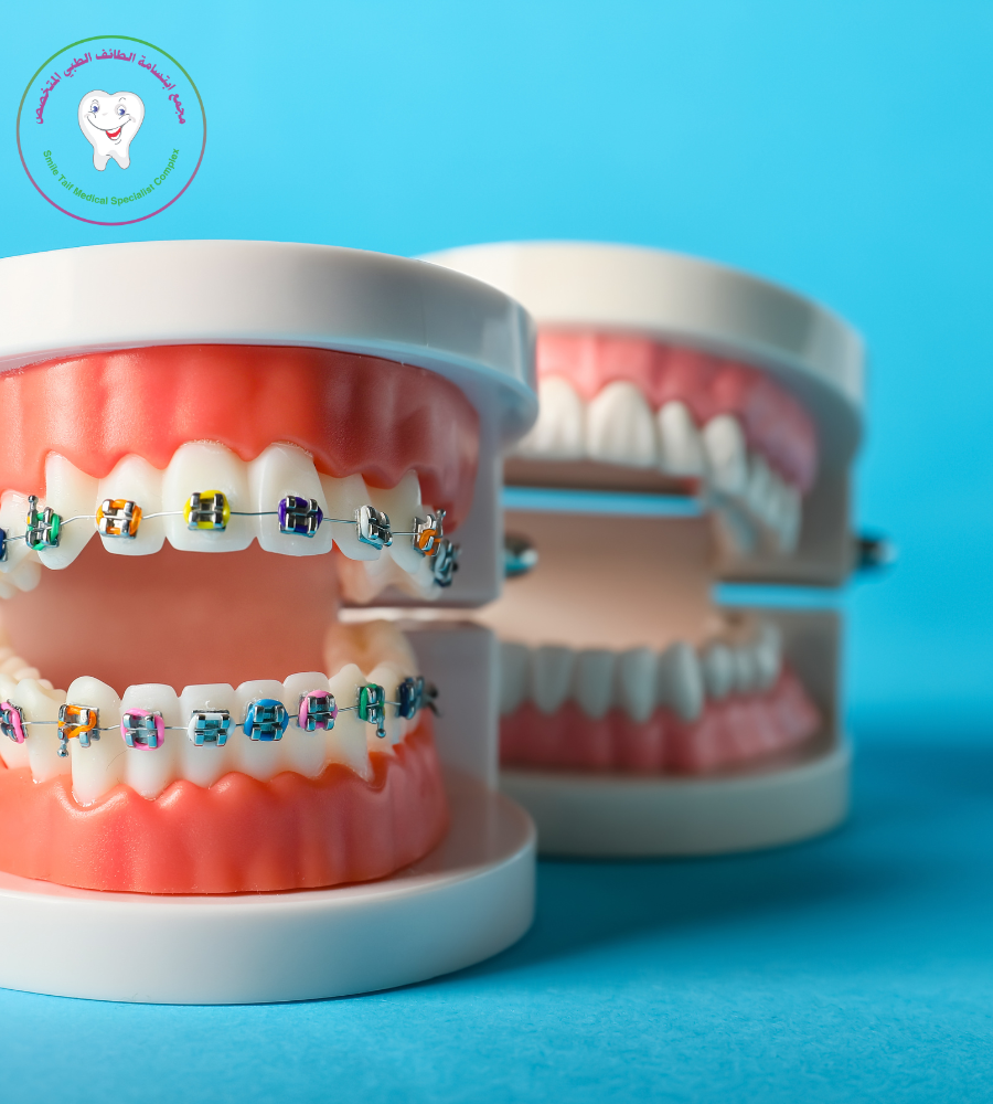 تقويم الاسنان مجمع ابتسامة الطائف الطبي