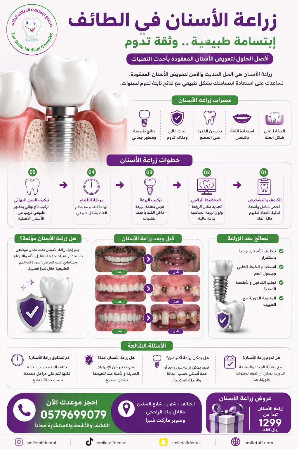أفضل-مركز-زراعة-أسنان-في-الطائف.png