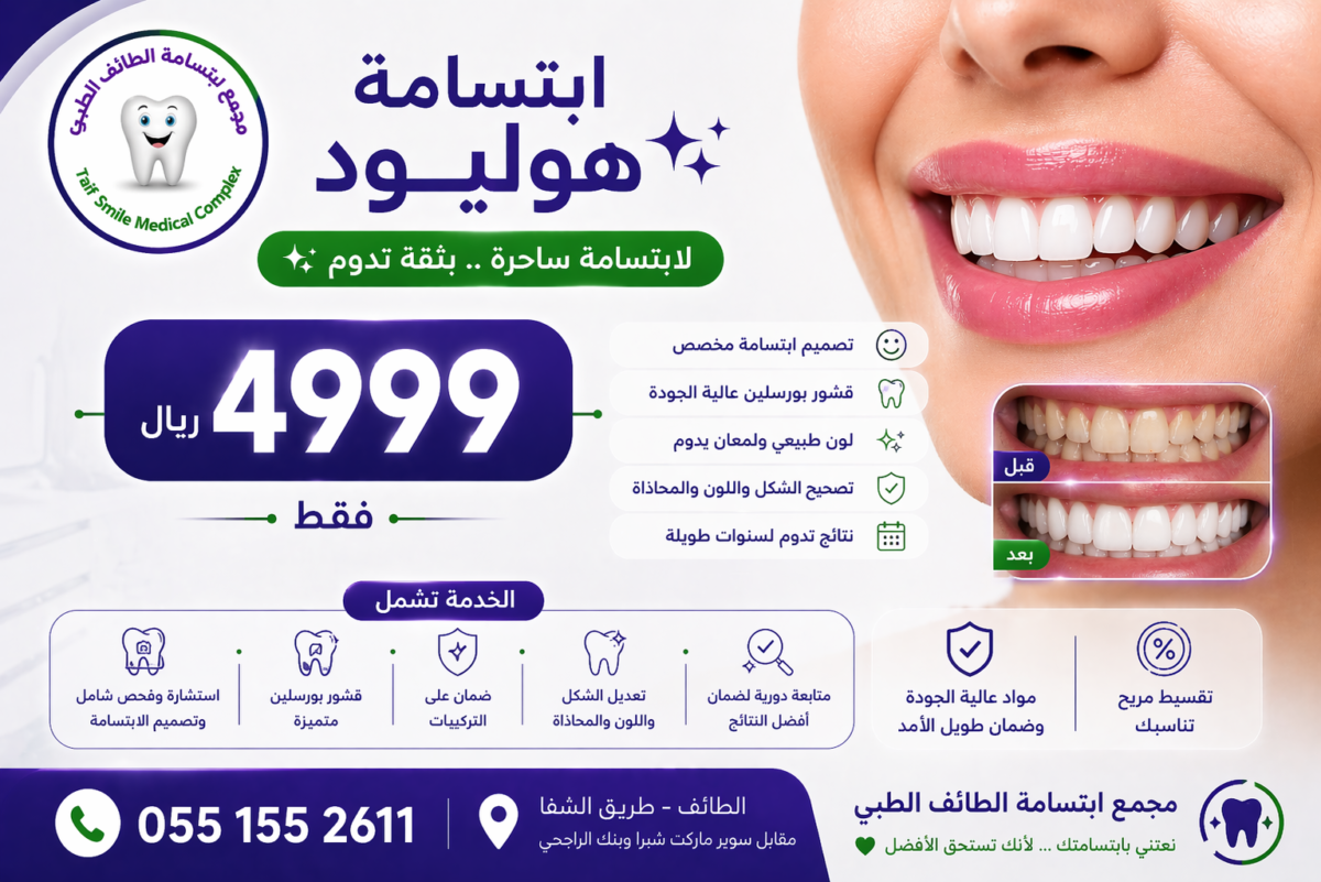 ابتسامه هوليود
