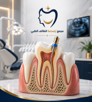 علاج جذور الأسنان في الطائف باستخدام تقنيات حديثة للحفاظ على الأسنان الطبيعية